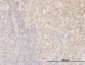 CFL1 Antibody (monoclonal) (M04)